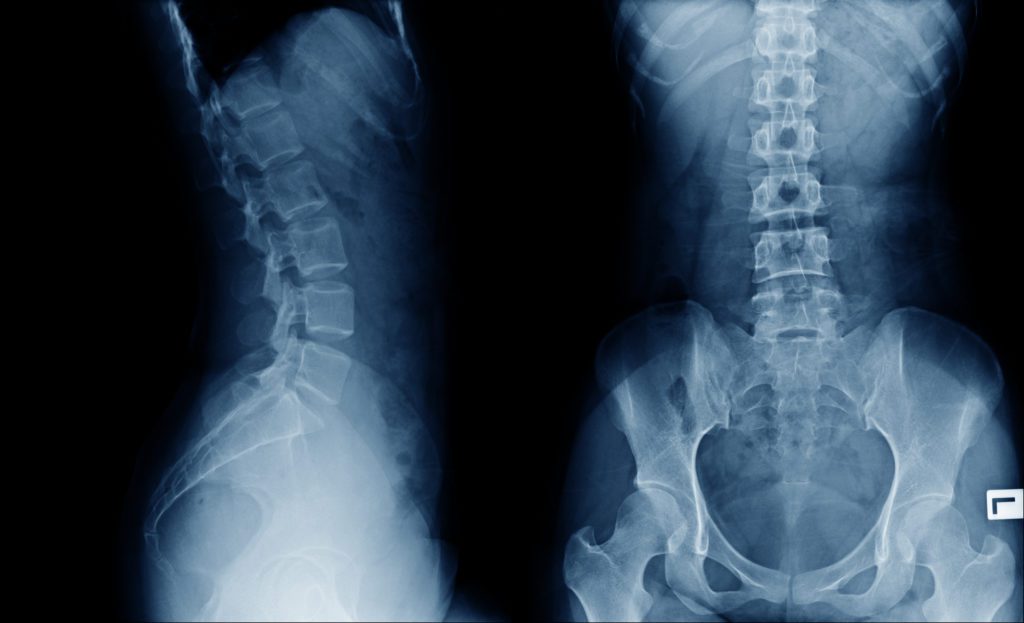 shutterstock_1246742272_Medical therapy